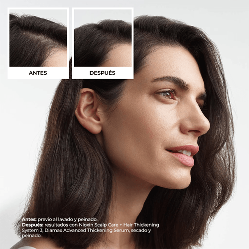Kit Scalp 3 - Shampoo 150ml + Acondicionador 150ml + Tratamiento 50ml